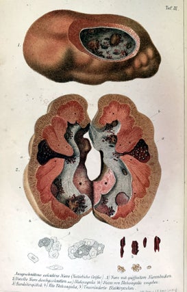 Chirurgie der Nieren