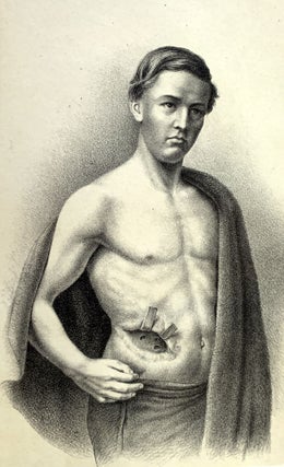 Chirurgie der Nieren