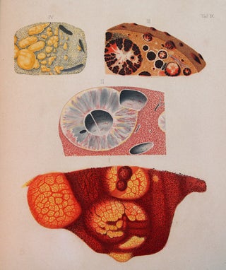 Item #246 A clinical treatise on the diseases of the liver. Translated by Charles Murchison. F....