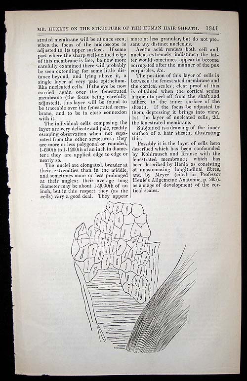 Item #4106 "On a hitherto undescribed structure in the human hair sheath." In London Medical Gazette, Vol. 36. T. H. HUXLEY.