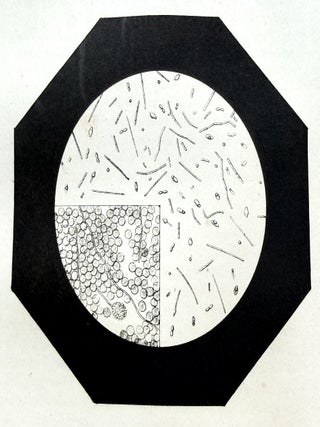Ferments et maladies. E. DUCLAUX.